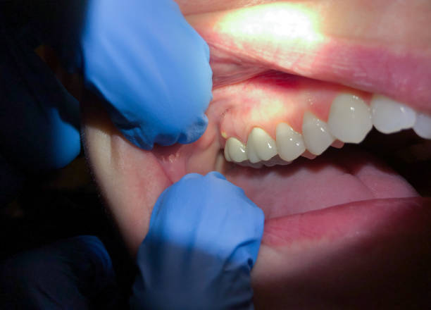 Best Emergency Gum Pain Relief  in Cushing, OK